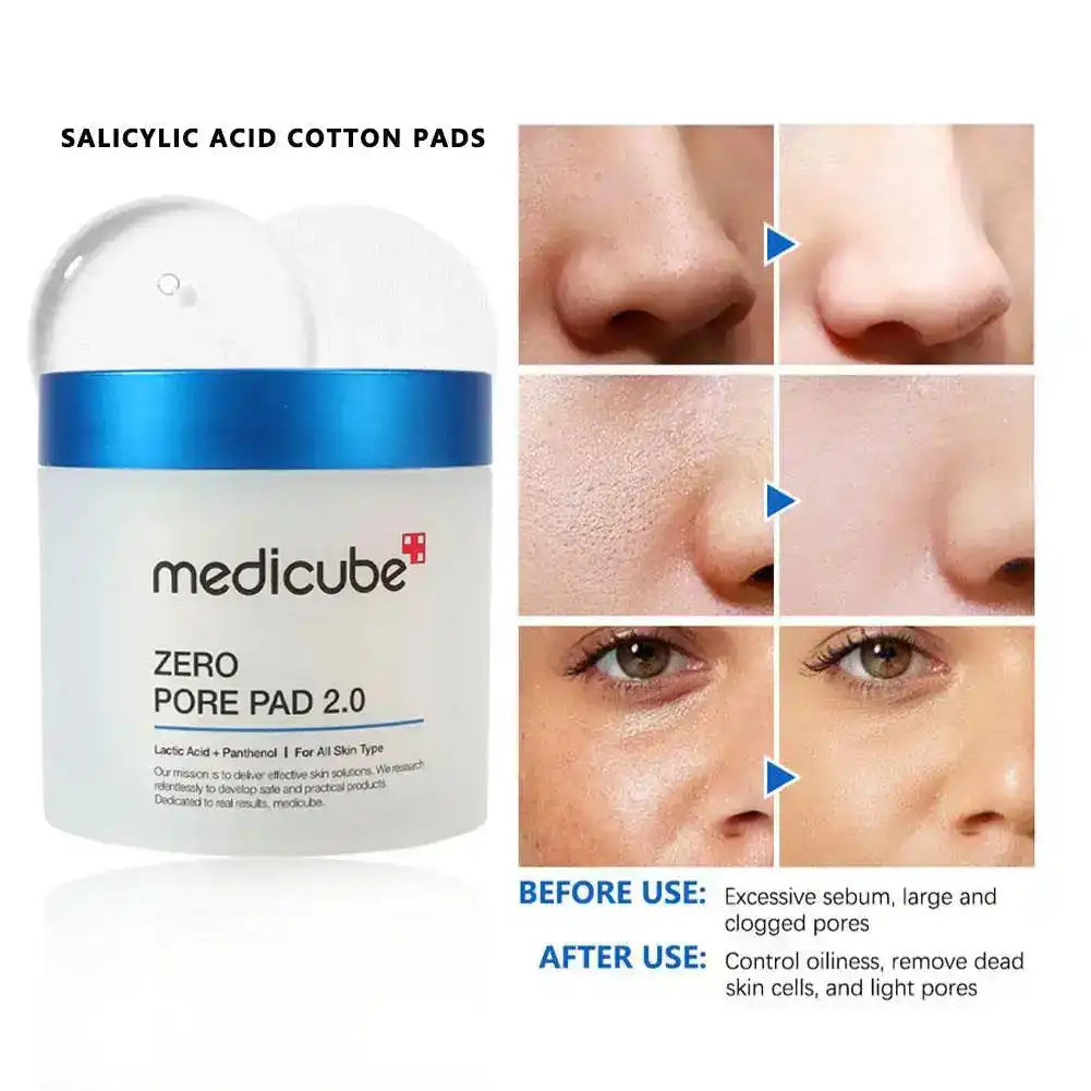 Aqualum Facial Toner Pads - Salicylic Acid Toner for clear skin, featuring a jar of cotton pads and before-and-after pore cleansing results on facial skin.
